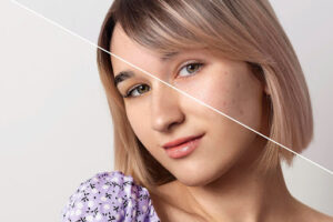 Photo Retouching: What It Is and Why You Need It?