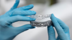 Why Retainers Are a Game-Changer for Teeth Grinding Sufferers